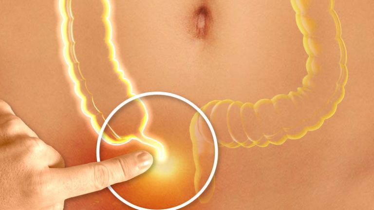 Your Appendix: More Useful Than You Might Imagine